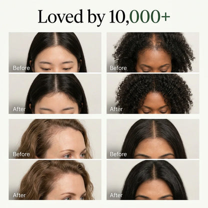 Korean Scalp Revival Bar.